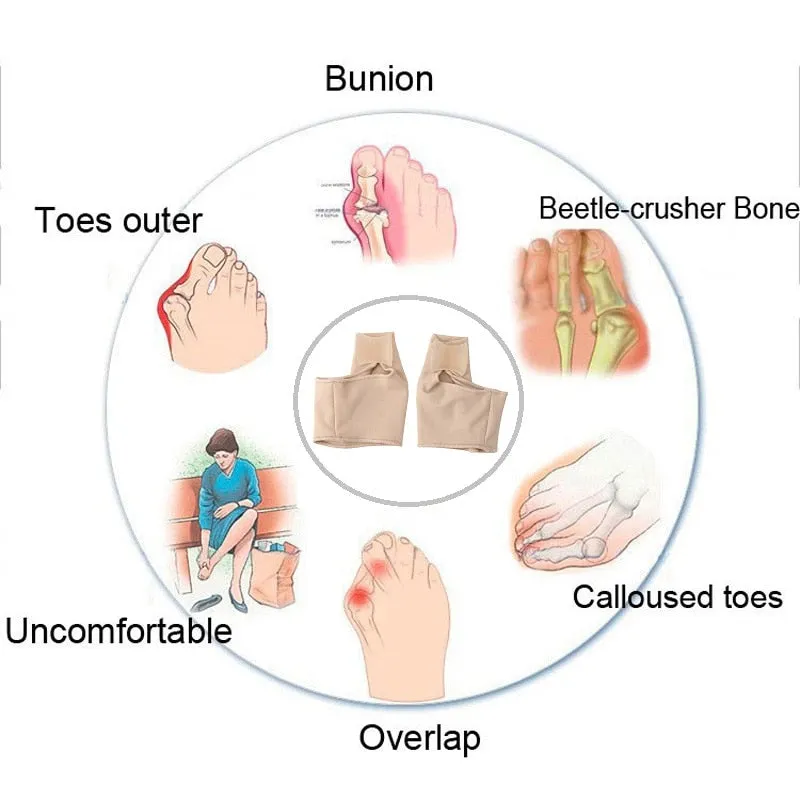 Hallux Valgus Bunion Orthotic Corrector