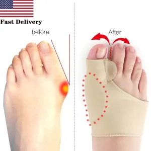 Hallux Valgus Bunion Orthotic Corrector